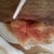 My wound 8/27/10