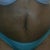 3 Weeks Post Op
