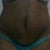 3 Weeks Post Op