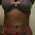 Front view 5 weeks post op