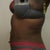 Side view 5 weeks post op