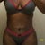 Front View 5 week Post op