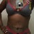Front View 5 week Post op