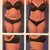Before and after pics from my surgeon's office.  Really amazed at the difference before and 5 months post op.