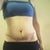 5 wks post op