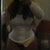 She filled in my hips perfectly  3 days PO