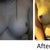 my before and after 2 months =).... My before was done by DR Yarish... not Moliver.