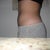 11 days after side