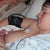 RIght after birth by emergency C-section
