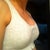 day 3, they look so weird from the sides without any bra, you can kind of see what i mean in this pic