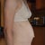 2.5 years before surgery - Side view
