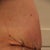 Day 12 Post - Side view