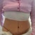 TUMMY POST OP DAY 2