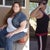 Before weight loss and after losing 100 pounds. Both are prior to surgery.