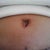 Jan 3 2012 4 more days till 4 weeks post op. BB healing really well.
