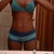 Day 4 after mini tummy tuck