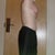 two weeks post op