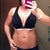 Day 1 post op. 36D bra.