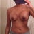 Post op two weeks
