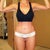 3 months post op