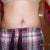 Front view still looks odd to me, seems like I don't have a waist anymore. Hoping that is the swelling