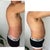 before then day 1 without swelling then how it swells back day 3-6