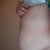 my left side before