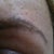 Pre-shot. Grey tattoo with some out-of-line stripes. Way too thick on this side, and not to brief (I wanted them thickest near my nose then to taper out over the arch).