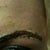 This is about 3 hours after having the Rejuvi applied.