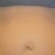 PRE OP - Herniated belly button close-up