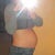 PRE OP - Big fat belly after 2 kiddos and no stretch marks, thank goodness!