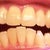 5-9-2012 Tray 5/24