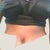 belly button - 1 week post op