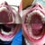 Kind of a weird picture, but the left is my upper and lower jaws on day one, and the right is my upper and lower jaws after trays 8 of 16. Halfway through!