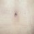 27 days,,,new bb and scar from old one