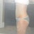 Tummy tuck revision 8 months post-op tummy tuck.  Lots of lipo bruising.