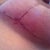 6 Wks PO: right breast incision. Posting these to compare to my 12 day po pics.