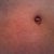 6 Wks PO: close up of belly button. The fold inside are a little more pronounced than before. I wonder if it's swelling or things just settling in.