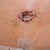 Day 8-Close up of my new belly button