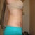 5 weeks post op