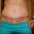 5 weeks post op!! YAY!