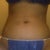 after pic, took on 2/20, front