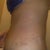 after pic, took on 2/20, side