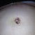 2 weeks post op