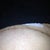 2 weeks post op