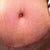 This is just three days later, right before my two week check up.  See how much better the scar looks already?  And the playdoh lumpy look is almost gone.  And hello, cute belly button!! <3