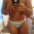Scar easily hidden behind underwear!!