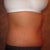 8 wks PO. Right side view.