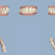 My teeth BEFORE treatment.