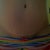 my scar again at 9wks